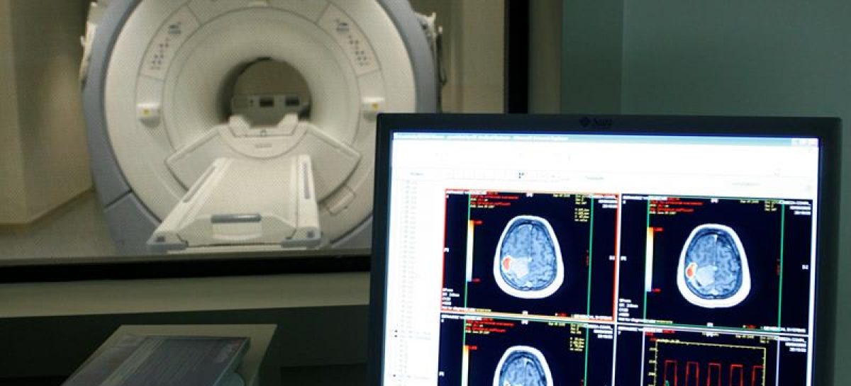 Científicos logran prevenir el Alzheimer mediante la inyección de un gen en el cerebro
