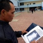 Un vietnamita vivió 18 años con unas tijeras en el estómago