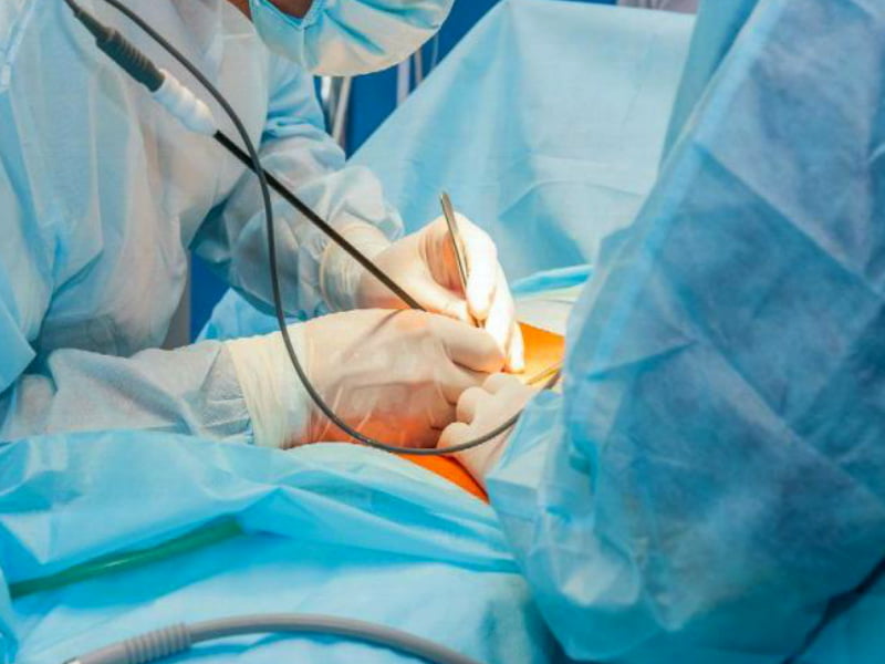 Murió una mujer de Veraguas tras realizarse cirugía estética