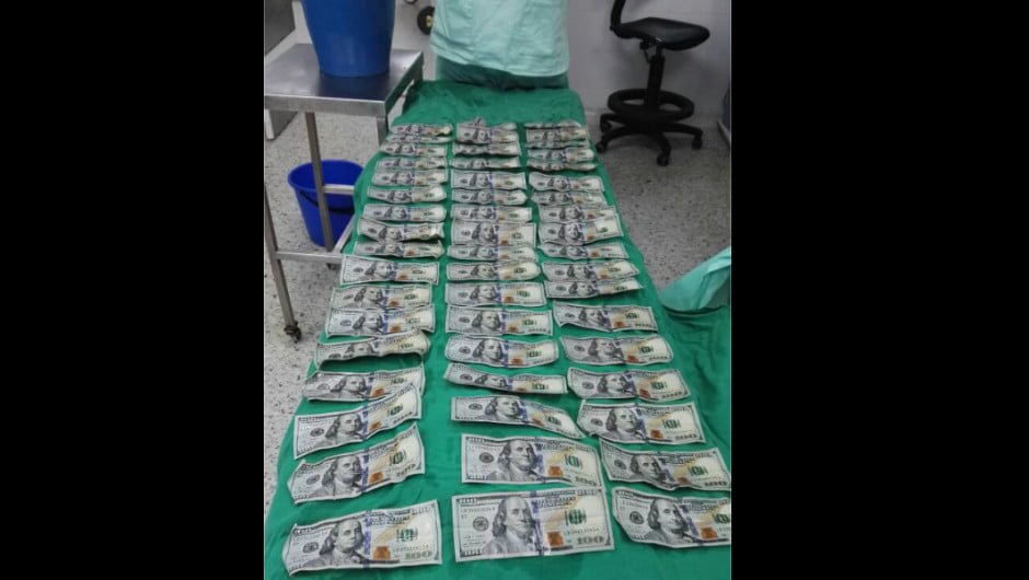 Mujer se tragó 7.000 dólares en billetes de 100 por una pelea familiar