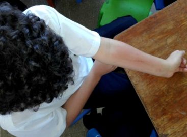 50 estudiantes de escuela en La Chorrera presentaron rara reacción alérgica