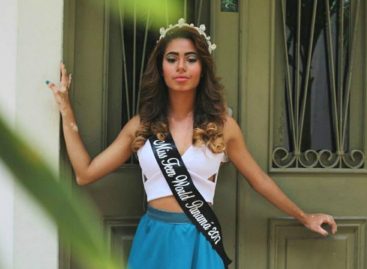 ¡Discriminación! Por tener vitiligo se le negó la participación a Miss Turismo Panamá Internacional