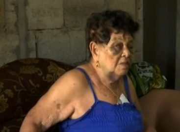 Denunciaron a sujeto que agredió brutalmente a señora de 88 años en Chiriquí