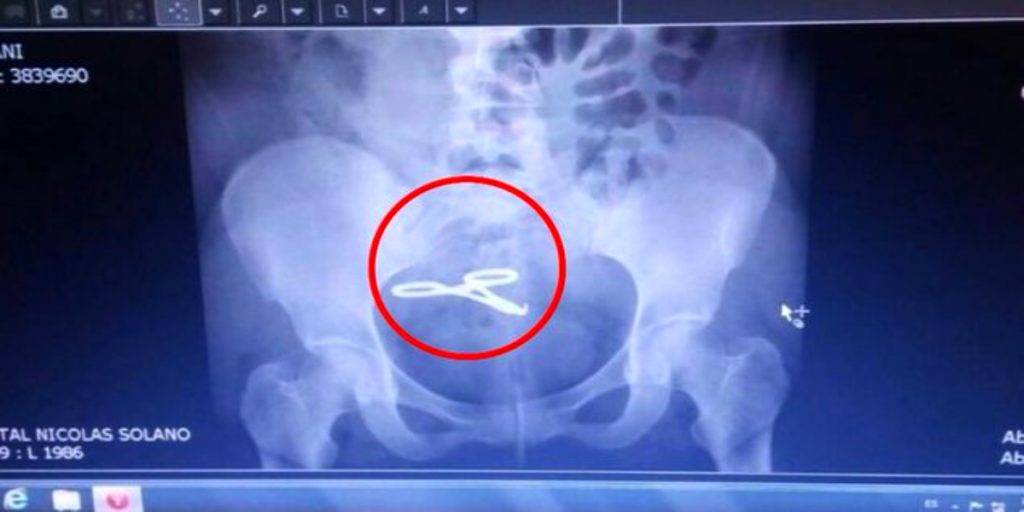 Hospital Santo Tomás