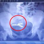 Hospital Santo Tomás