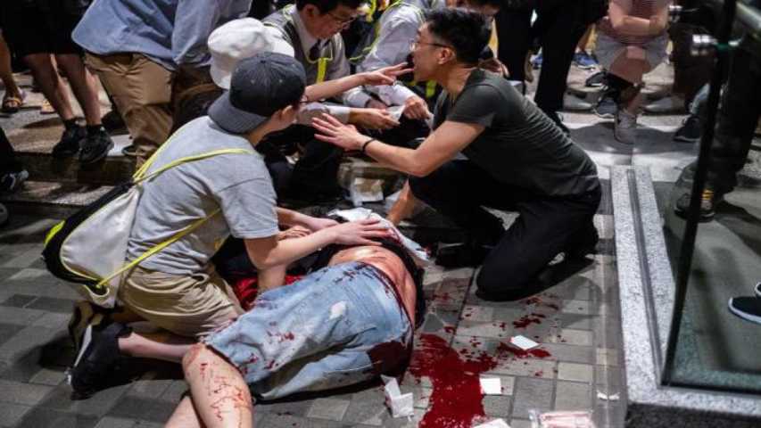 Policía Hong Kong condena ataque con cuchillo con 5 heridos, 2 graves