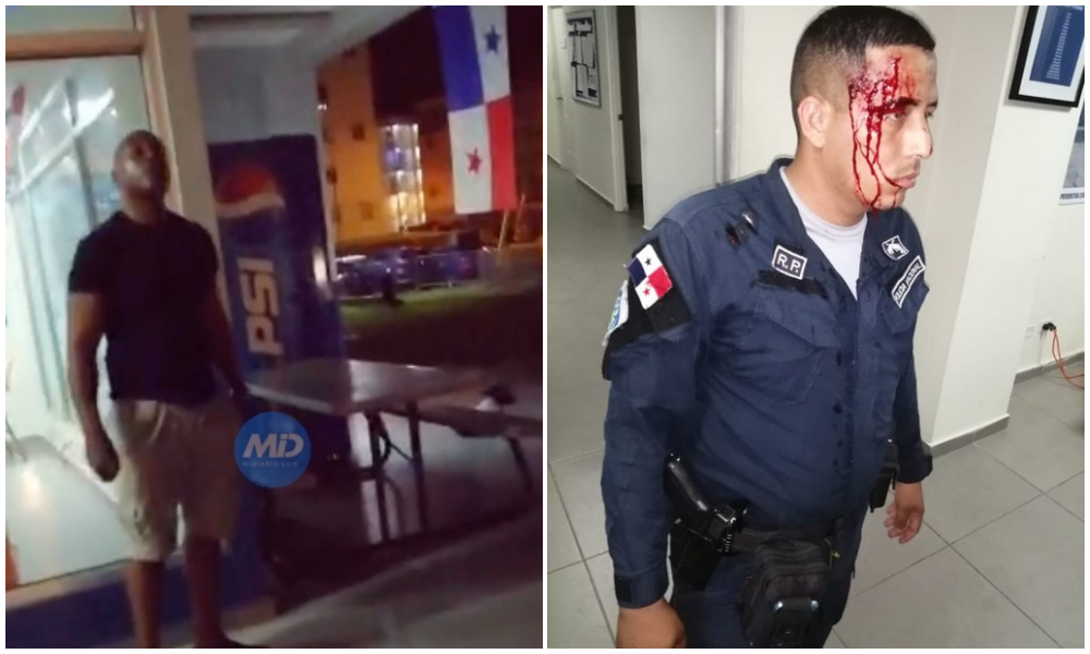 Jairo Salazar escándalo